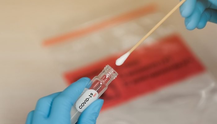 Covid-19,Nasal,Swab,Laboratory,Test,In,Hospital,Lab